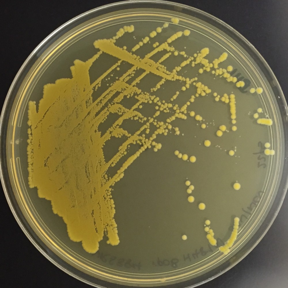 Staphylococcus on an agar plate. Credit Dr Jean Lee