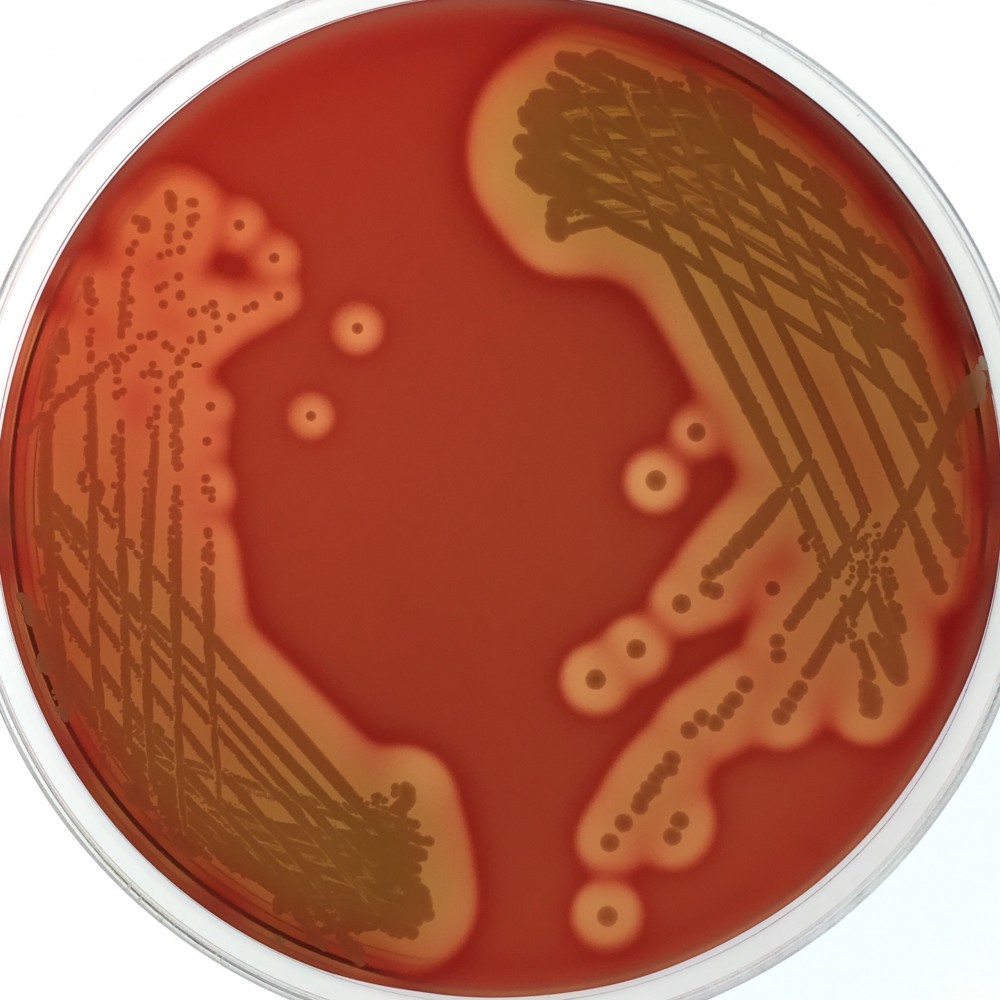 Staphylococcus epidermis on a blood agar plate. Credit Dr Jean Lee.