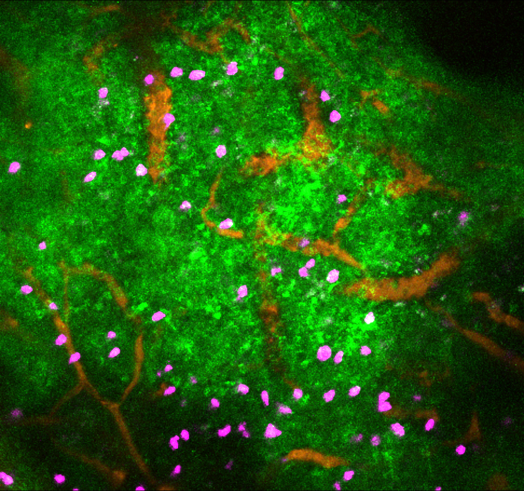 Credit Professor Scott Mueller. The image shows the impact of sympathetic nervous system activity in immune tissues (lymph node). Lymphocytes (purple) can be seen amongst blood vessels (orange) and the calcium signalling (green) that results from noradrenaline neurotransmitter release and causes immune cells to stop moving.