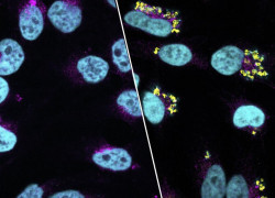 Scientists discover how Golden staph hides and thrives in human cells using state-of-the-art research tool