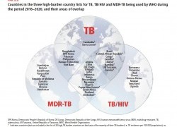 Genetics sheds light on the spread of tuberculosis bacteria