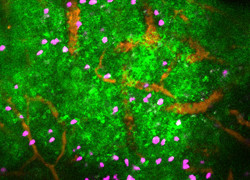 How stress can stop immune cells in their tracks