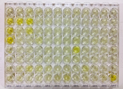 Explainer: Serological testing for COVID-19