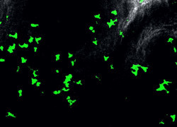 Researchers discover regulators of tissue-resident memory T cells