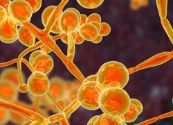 Explainer: what is Candida Auris and who is at risk?