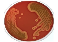Community-acquired golden staph infections on the rise
