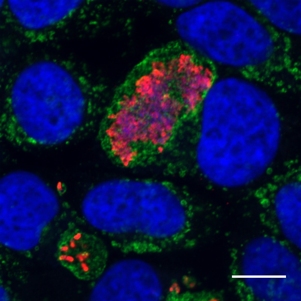 Coxiella (red) replicating within a membrane bound vacuole (green) inside a human cell (nucleus = blue). Courtesy Dr Hayley Newton.